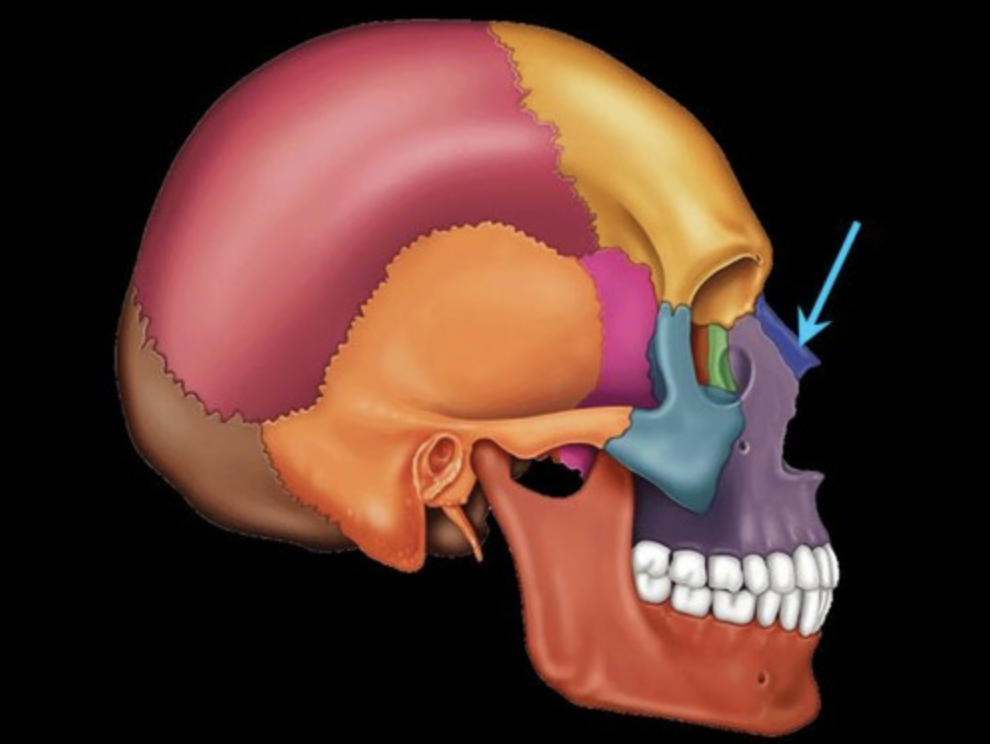 <p>form bridge of nose attached to cartilages that form nose</p>