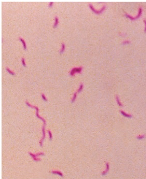 <ul><li><p class=""><strong>Gram-negative</strong>, <strong>curved/spiral bacilli</strong> (vibrios)</p></li><li><p class="">Often <strong>S-shaped</strong> or appear as <strong>gull-winged pairs</strong></p></li><li><p class=""><strong>Polar flagellum</strong> for motility</p></li><li><p class="">Commonly found in <strong>intestinal</strong>, <strong>genitourinary tracts</strong>, and <strong>oral cavity</strong></p></li></ul><p></p>
