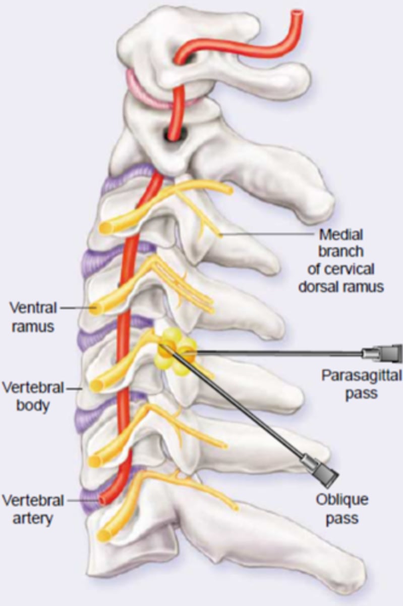<p>medial branch of dorsal ramus</p>