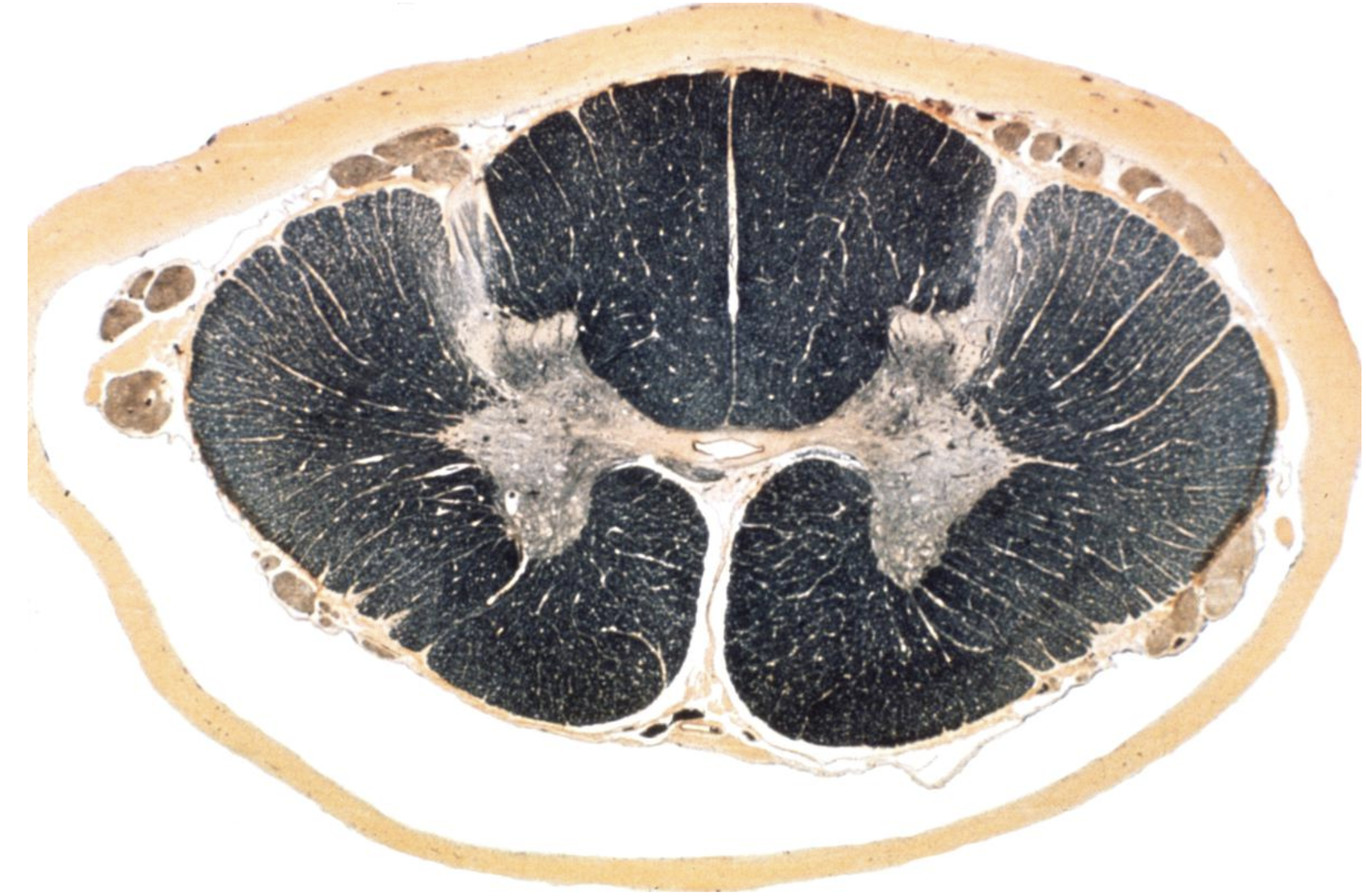 <p>Thoracic</p>