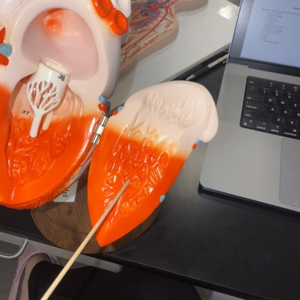 <p>Identify the muscle.</p>