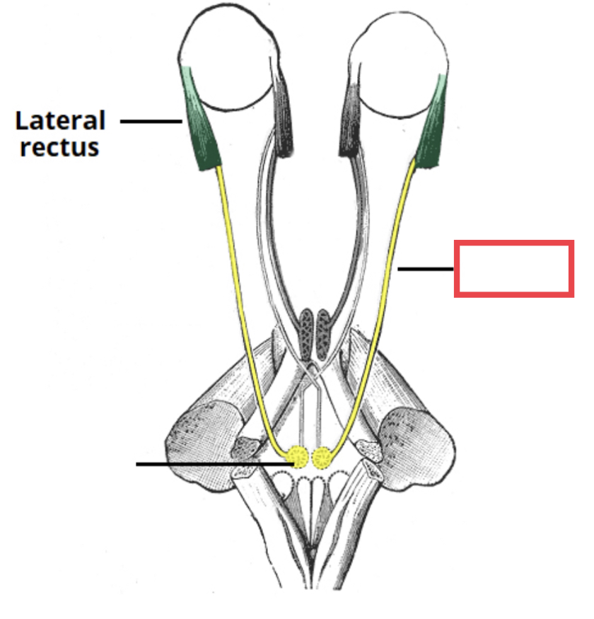 sixth cranial nerve; responsible for contraction of one of the extraocular muscles