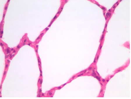 <p>What type of tissue is this?</p>