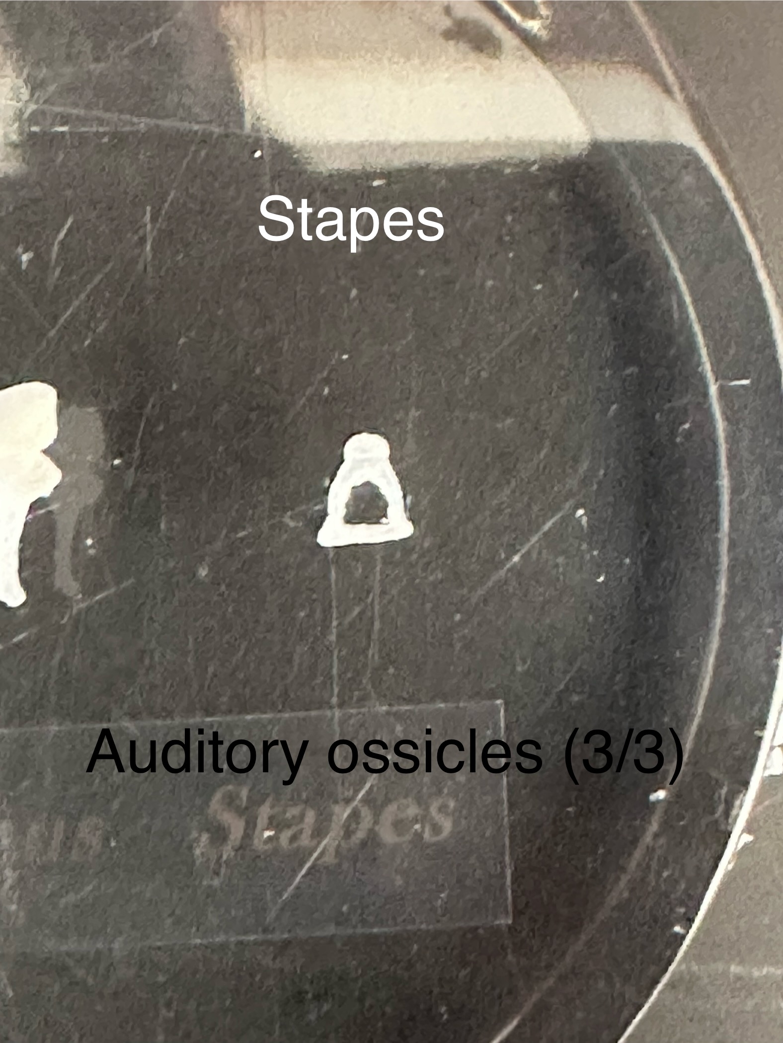 <p>Stapes: auditory ossicles</p>