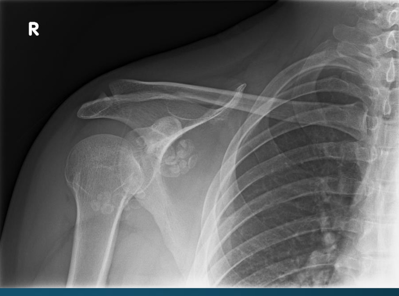 <p>what is this finding? </p>