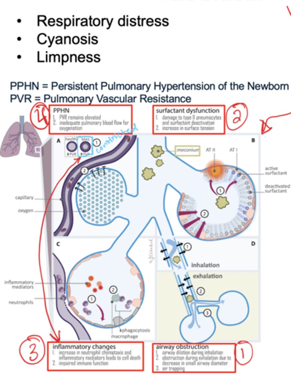 <p>1. Airway obstruction (respiratory distress)</p><p>2. Surfactant dysfunction (damage to type II pneumocytes - increases surface tension) baby appears cyanotic</p><p>3. Inflammatory changes (high neutrophil count - causes cell death)</p><p>4. Persistent pulmonary hypertension of the newborn</p>