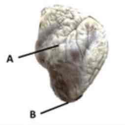 <p>Name these structures.</p>