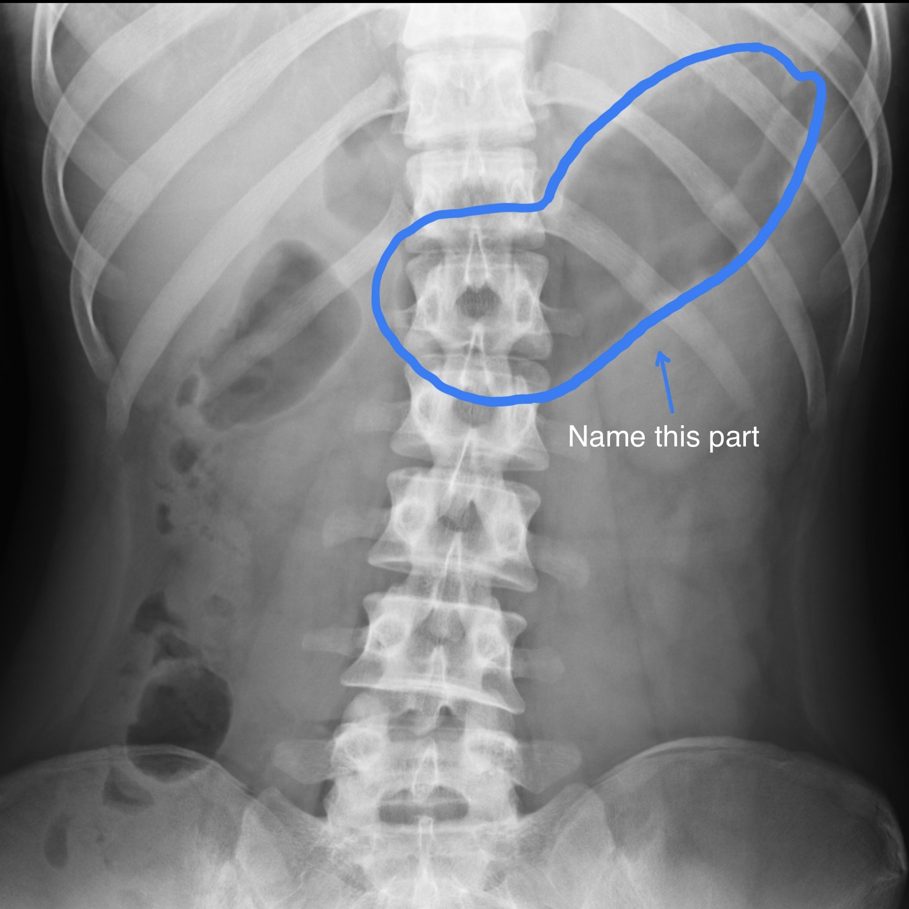 <p>Name the part and state its features</p>