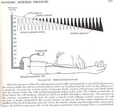 <p>What does this refer to</p><ul><li><p>Place a blood pressure cuff on patient’s arm</p></li><li><p>Very slowly deflate cuff while listening for Korotkoff sounds</p></li><li><p>Note pressure you first hear sounds during expiration</p></li><li><p>Repeat process and record pressure where sounds are heard during inspiration</p></li><li><p>Difference between the two numbers is pulsus paradoxus</p></li></ul><p></p>