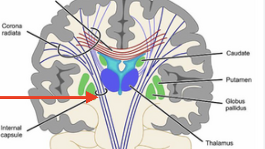 <p><span><mark data-color="unset" style="background-color: unset; color: inherit;">a thick band of white matter located deep within the brain, connecting the cerebral cortex to other parts of the brain and spinal cord</mark></span></p>