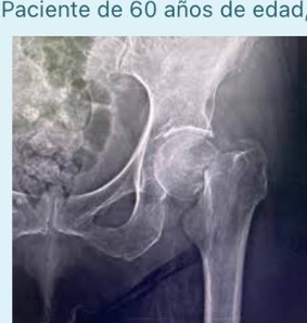 <p>CON ALTA DEMANDA FUNCIONAL TX?</p>