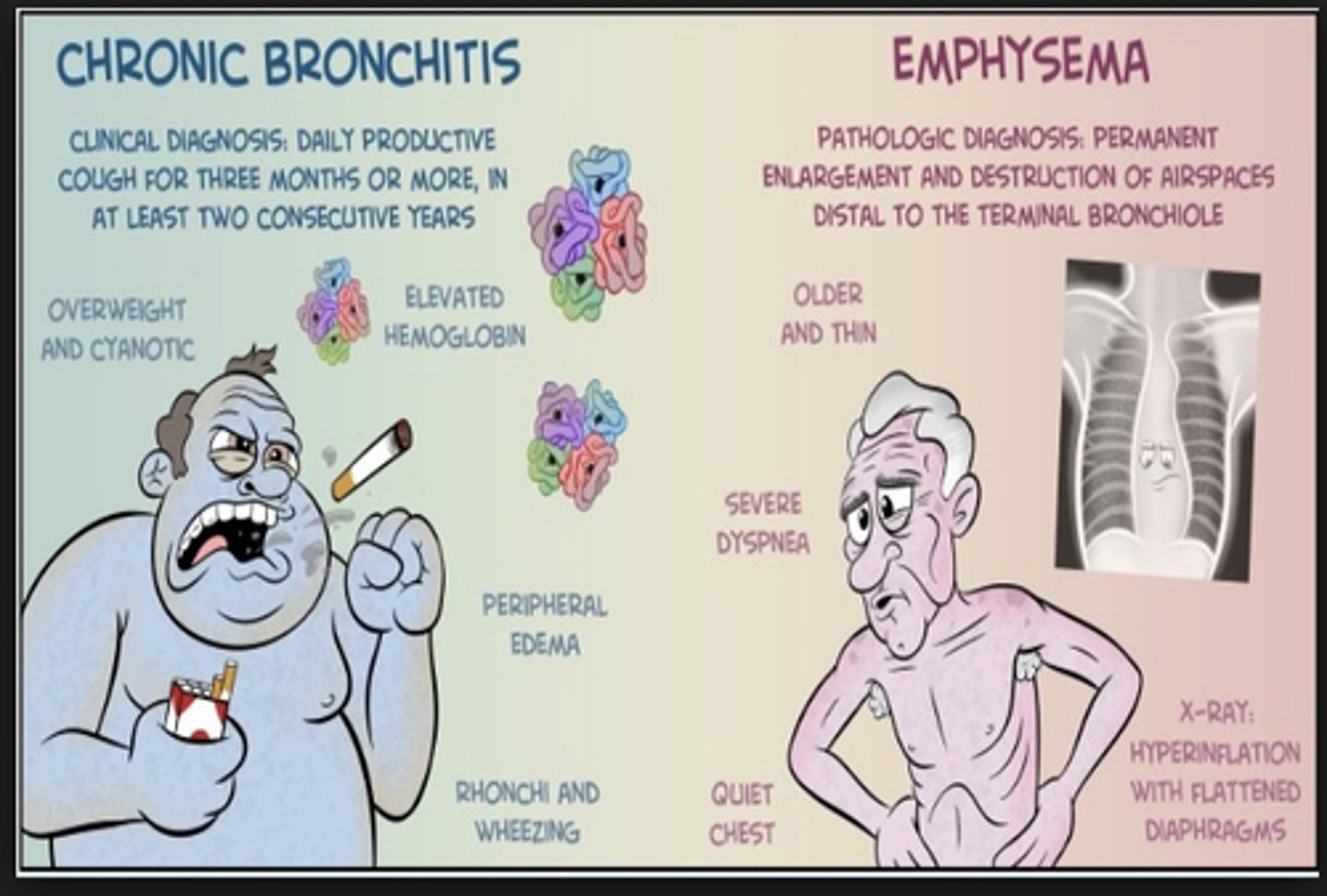 <p>"Blue bloater"</p><p>(chronic bronchitis: hyperplasia of mucous cells)</p><p>Clinical diagnosis from productive cough in 3+ months in at least 2 consecutive years</p>
