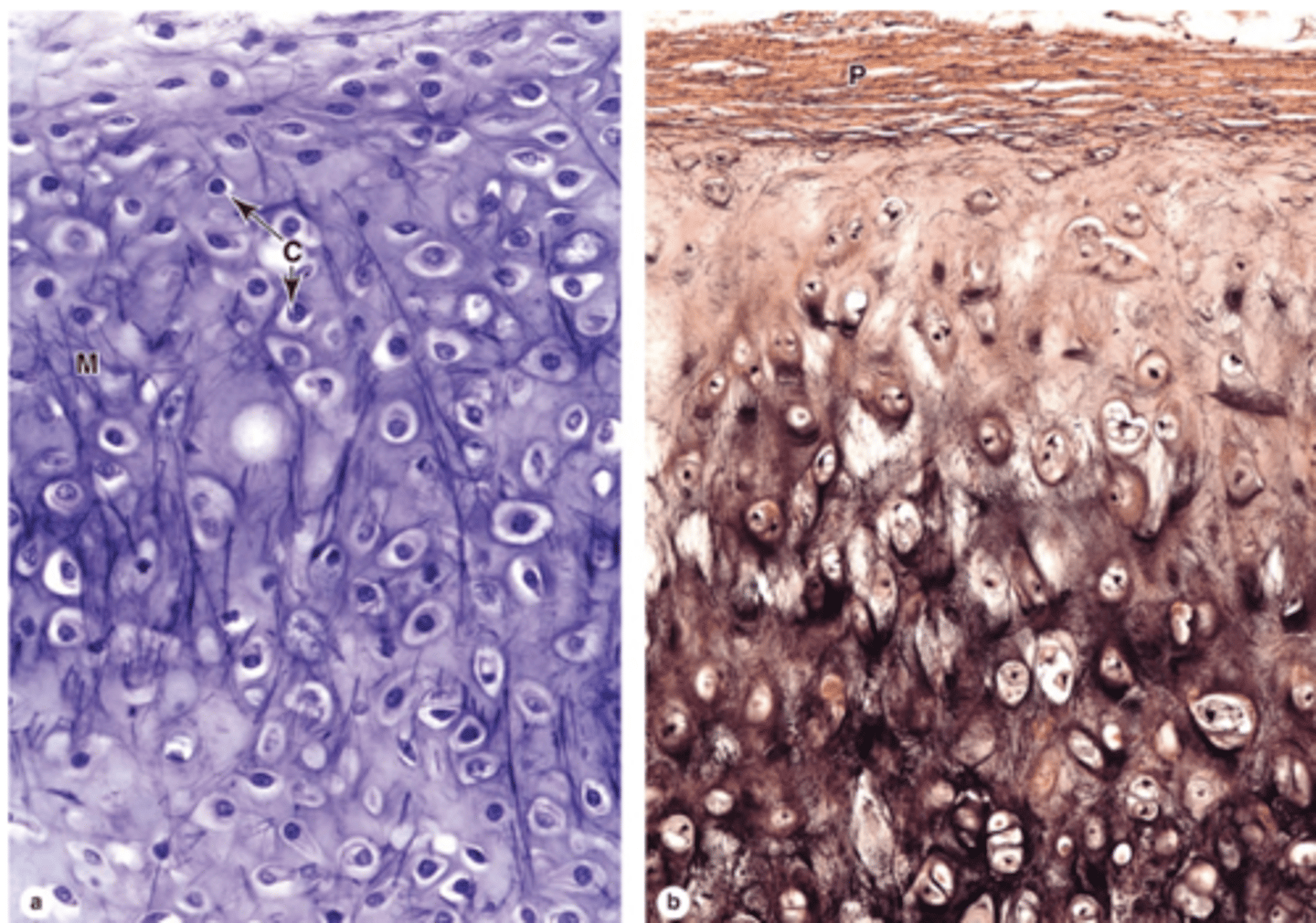 <p>Does elastic cartilage have a perichondrium?</p>