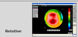 <ul><li><p>Smaller dioptric range per colour than absolute scales</p></li><li><p>Colours of 2 diff maps cannot be compared directly </p><ul><li><p>Provides a more detailed description</p></li><li><p>Removes smoothing effect</p></li><li><p>Cannot compare btwn eyes</p></li></ul></li></ul><p></p>