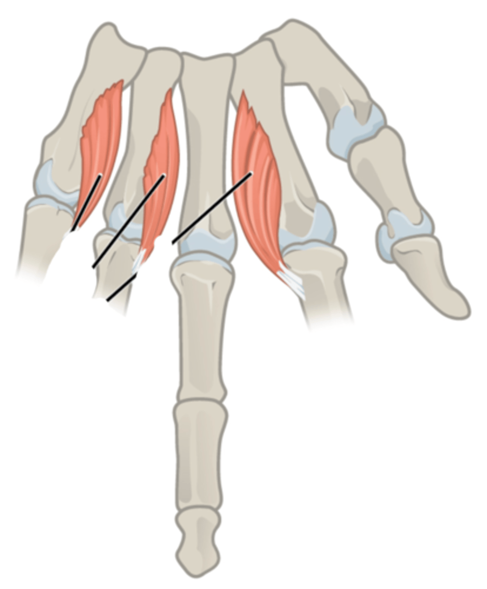 <p>ulnar</p>