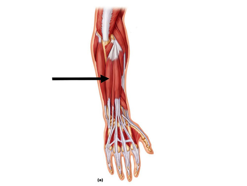 wrist extension, adduction