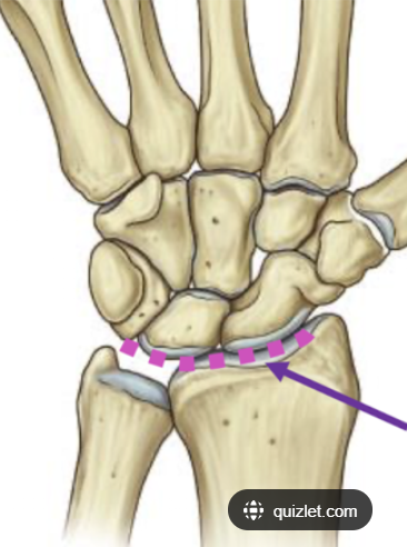 <p>What Joint is the<strong> purple arrow </strong>pointing to?</p>