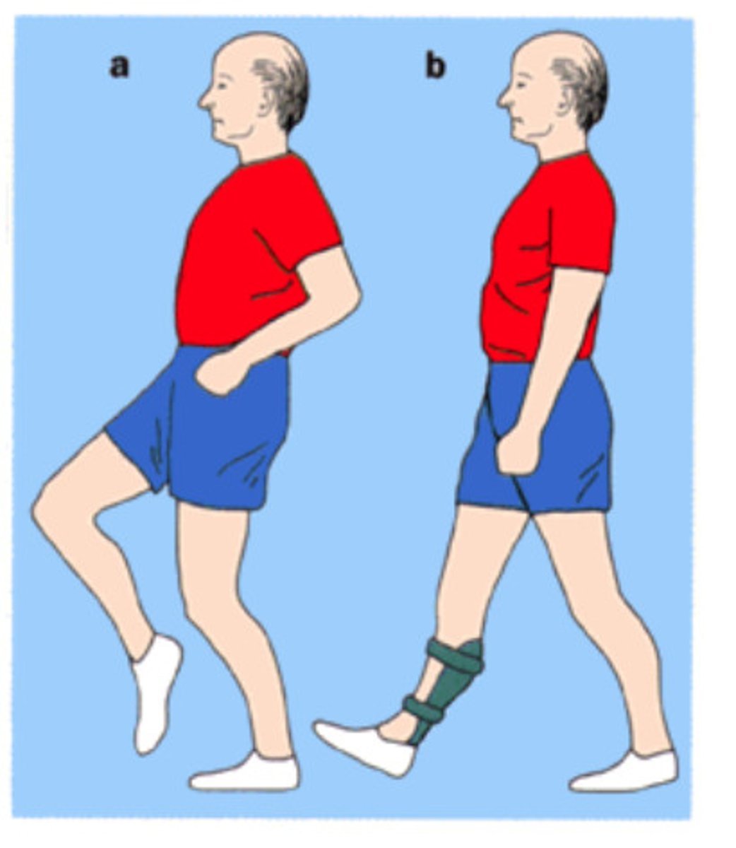 <p>passus m pas</p>