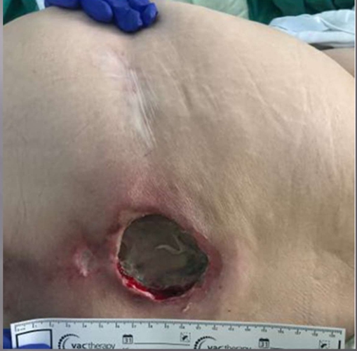 <p>What is the inury?</p>