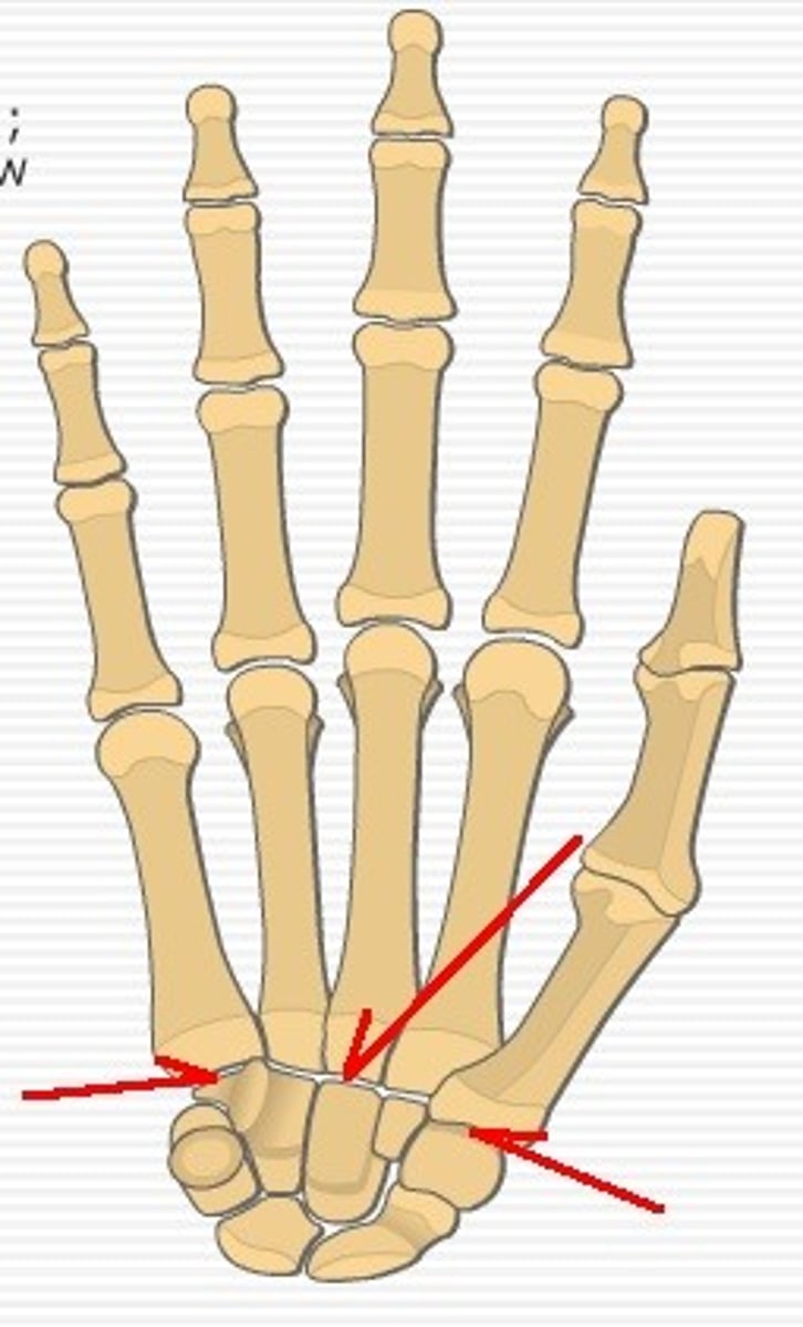 <p>Joints between carpals and metacarpals.</p><p>- Inconsistent classification: debate on plane vs. saddle joint</p><p>- 4th/5th joints more mobile than 2nd/3rd joints</p>
