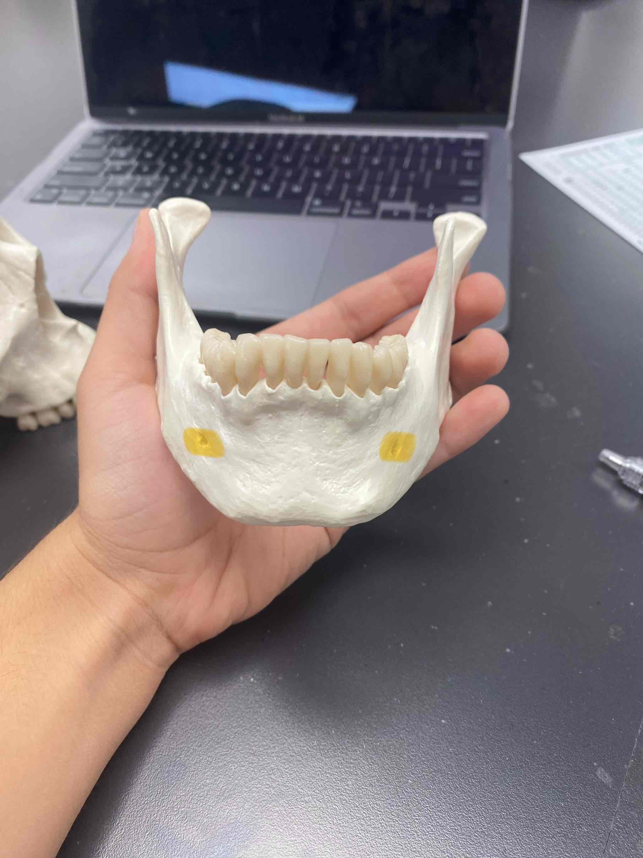 <p><span>name the bone and landmark</span></p>