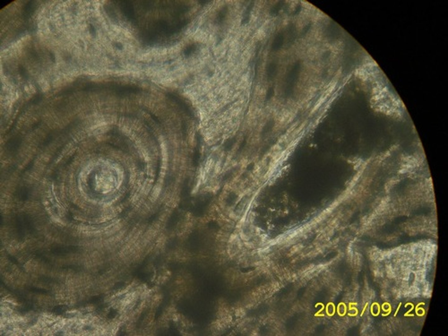 <p>more solid than cartilage and provides greater support; not as flexible; highly vascularized; rings called lamellae</p>