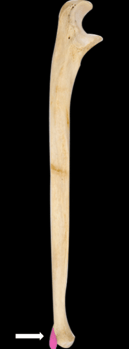 <p>name the part</p>