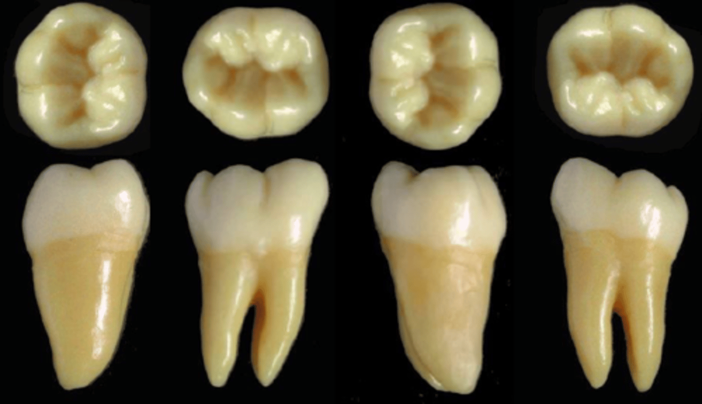 <p>what tooth is this &amp; why?</p>