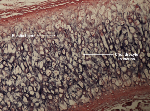 <p>connective tissue; more flexible and elastic than hyaline cartilage; contains elastic fibers; chondrocyte in lacunae; located in the epiglottis and pinna of the ear</p>