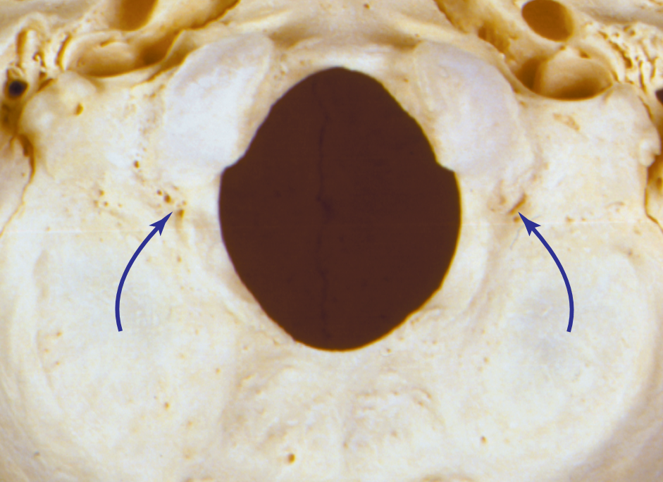 <p>What structure?</p>