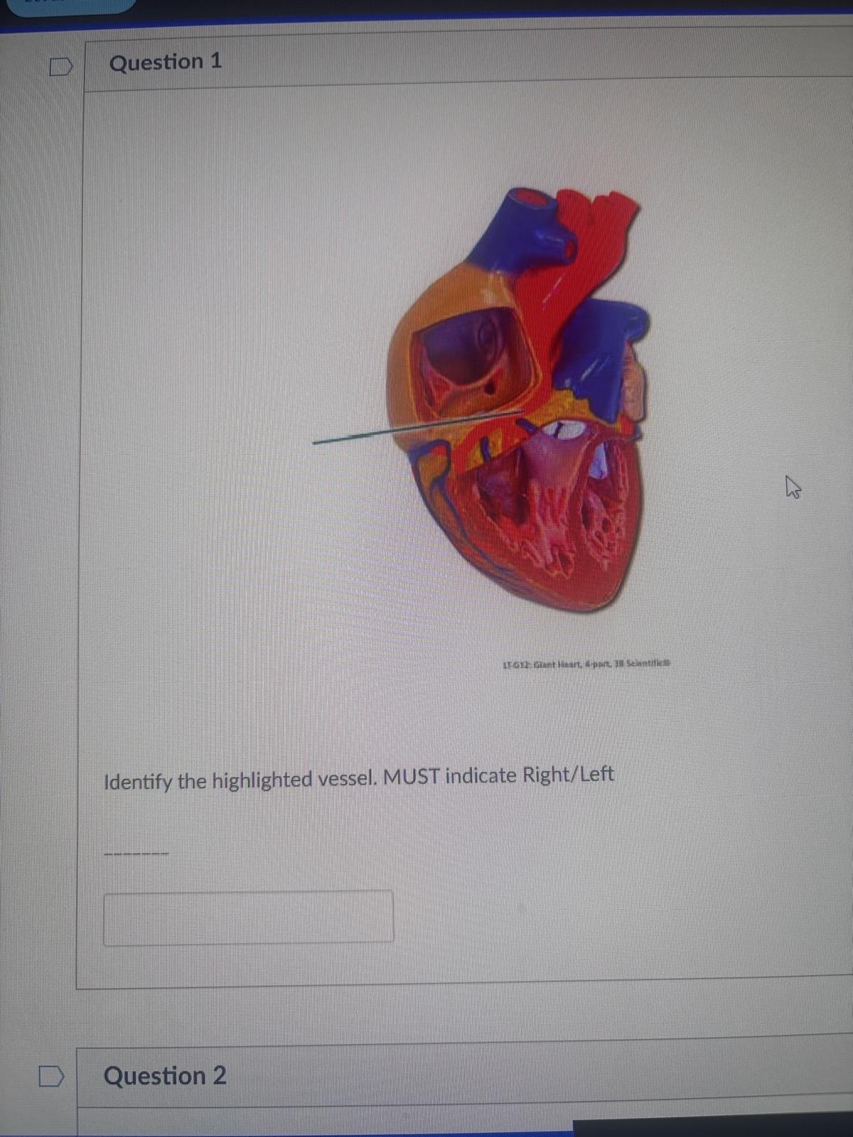 <p><span>Identify the highlighted vessel. MUST indicate Right/Left</span></p>