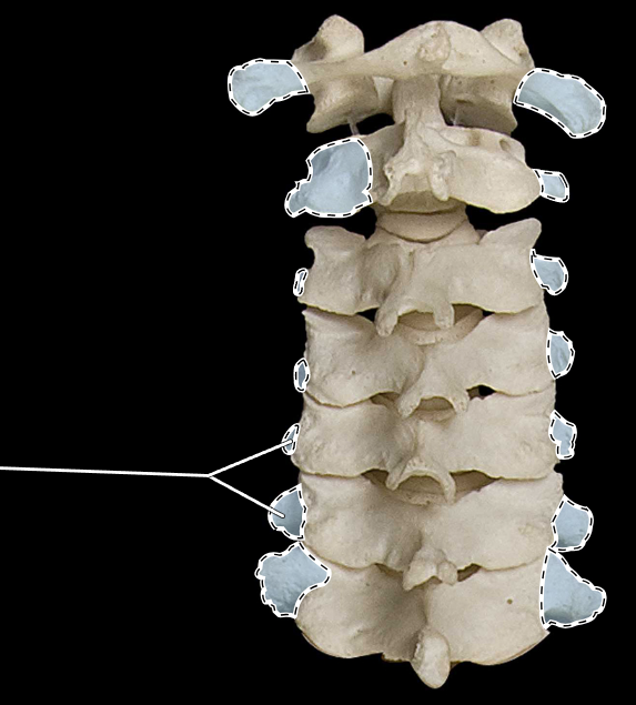 <p>What part of the vertebra is highlighted?</p><p>What region of the vertebral column is this?</p><p>(Posterior view).</p>