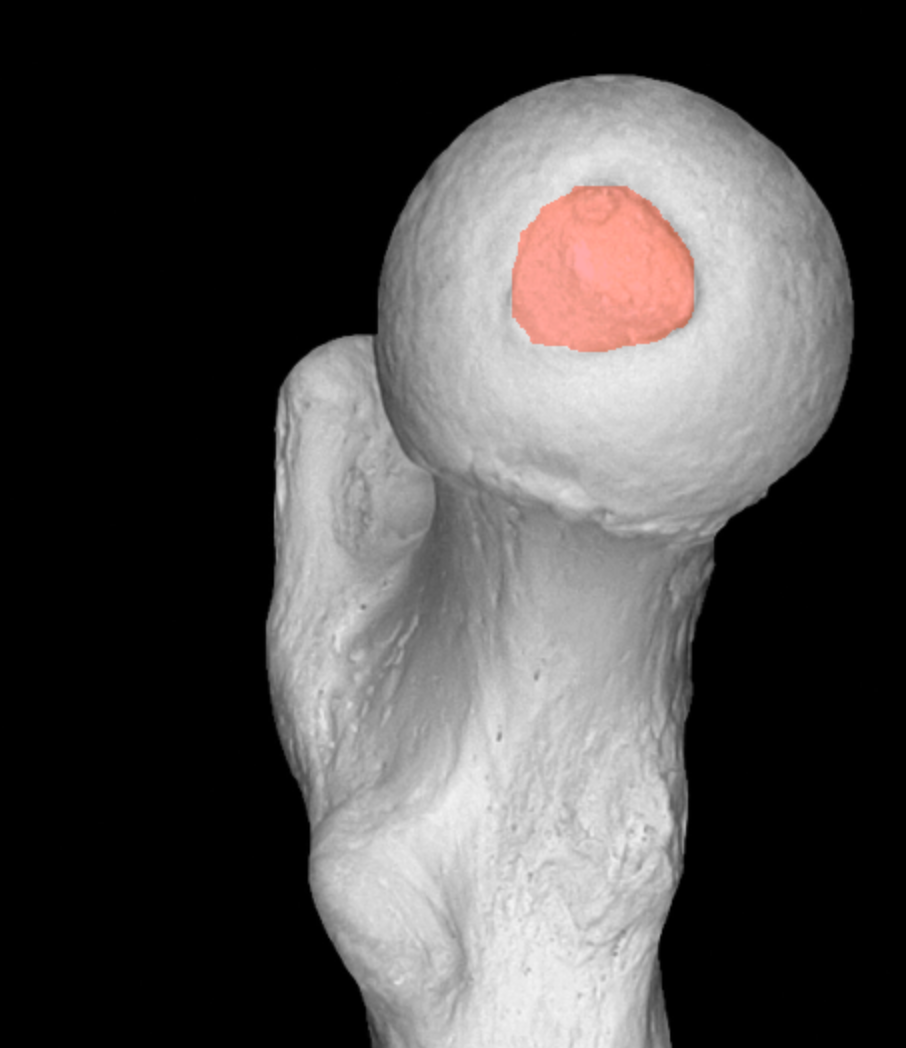 <p>indent on head of femur </p>