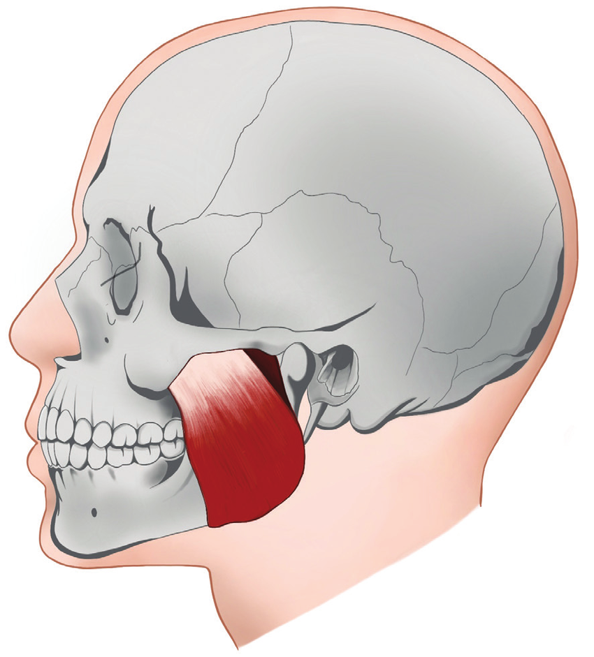 <p>Origin: Zygomatic arch</p><p>Insertion: Mandible</p><p style="text-align: start">Action: Elevates mandible</p>