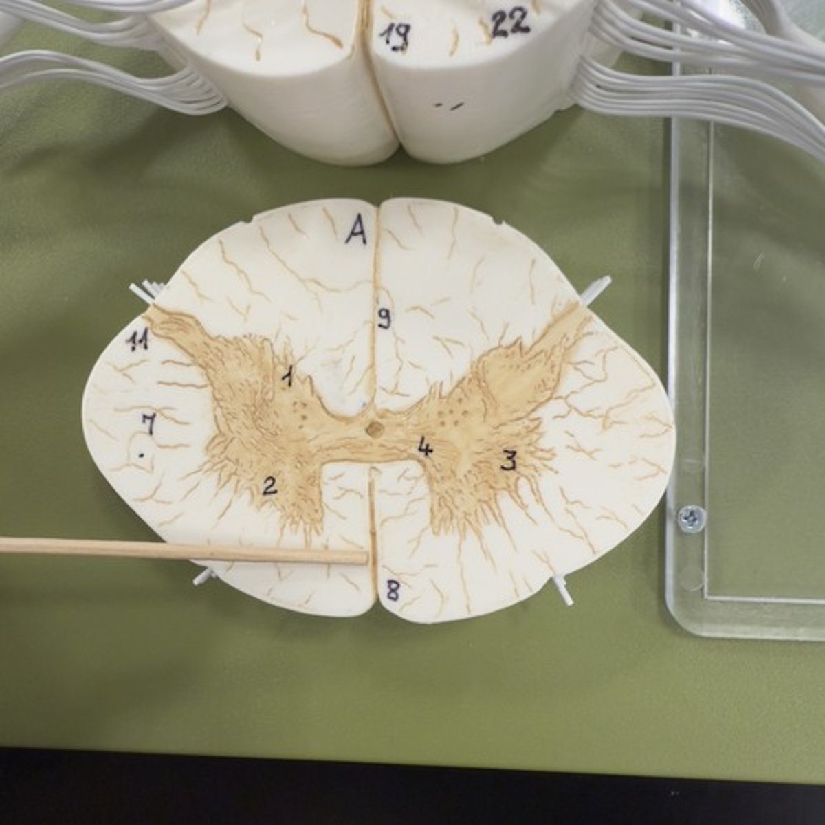 <p>Identify the structure.</p>