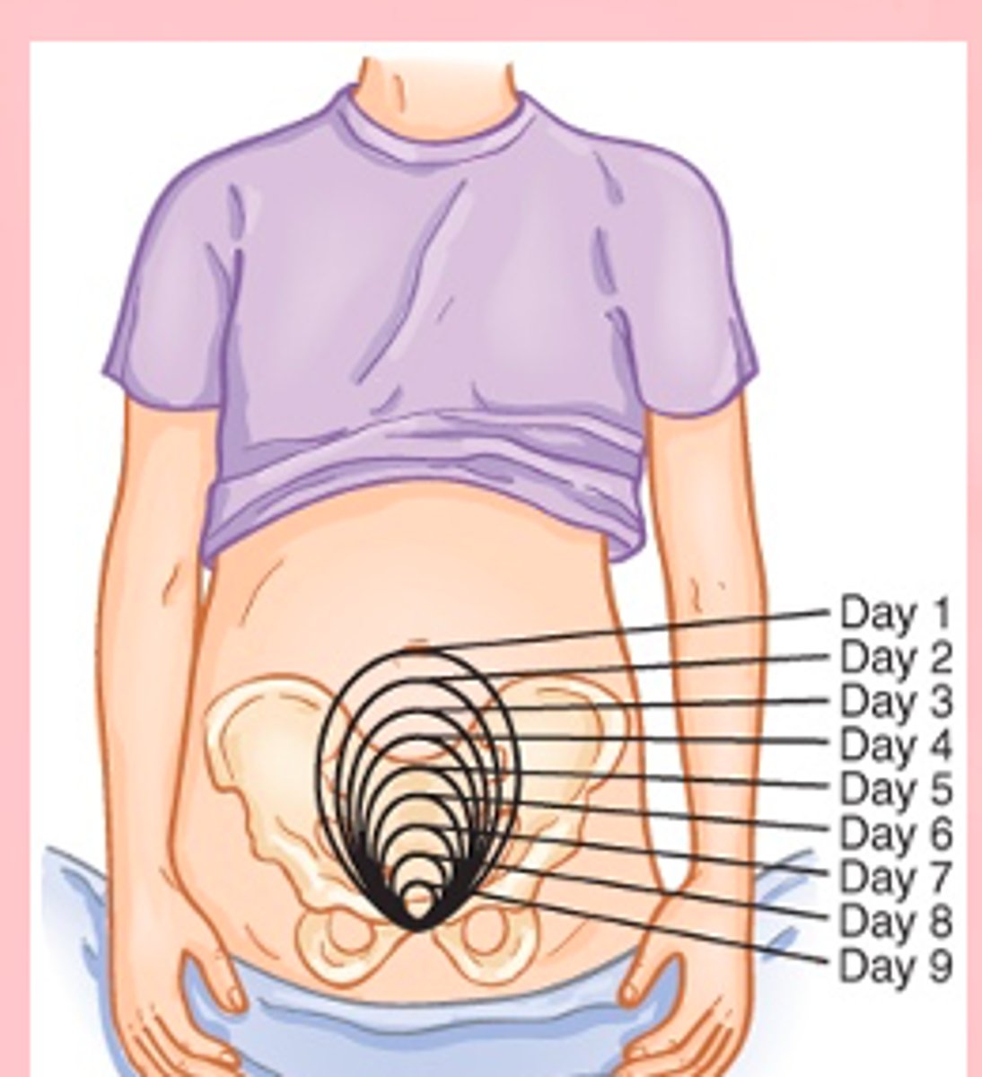 <p>is expected to descend approximately 1 cm (one finger-breadth) below the umbilicus</p>