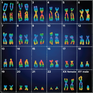 <p>Karyotype</p>