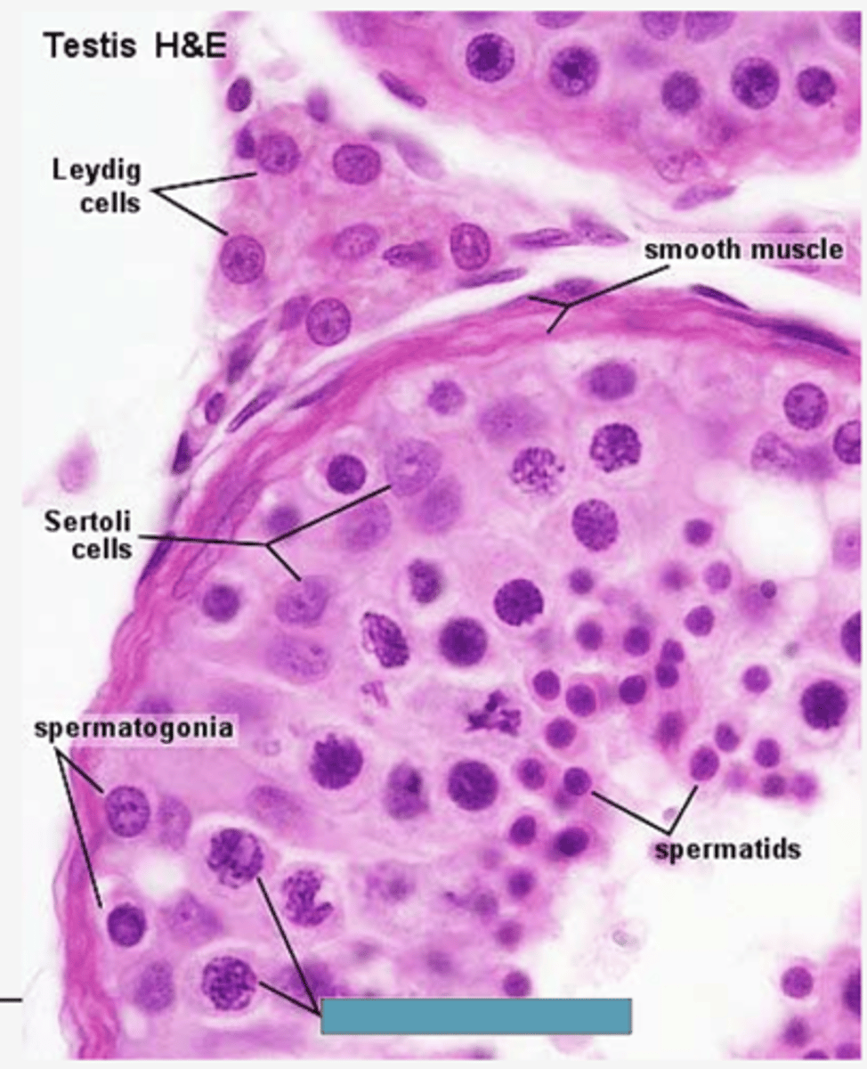 <p>Identify the cells</p>