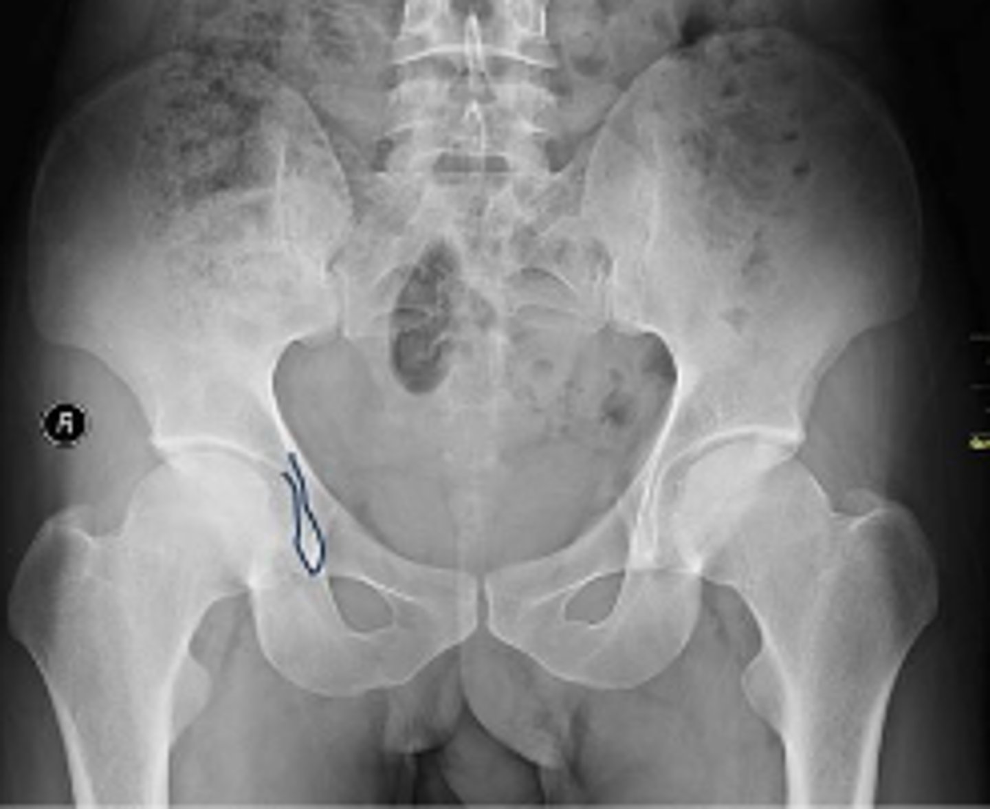 <p>What is outlined?</p>