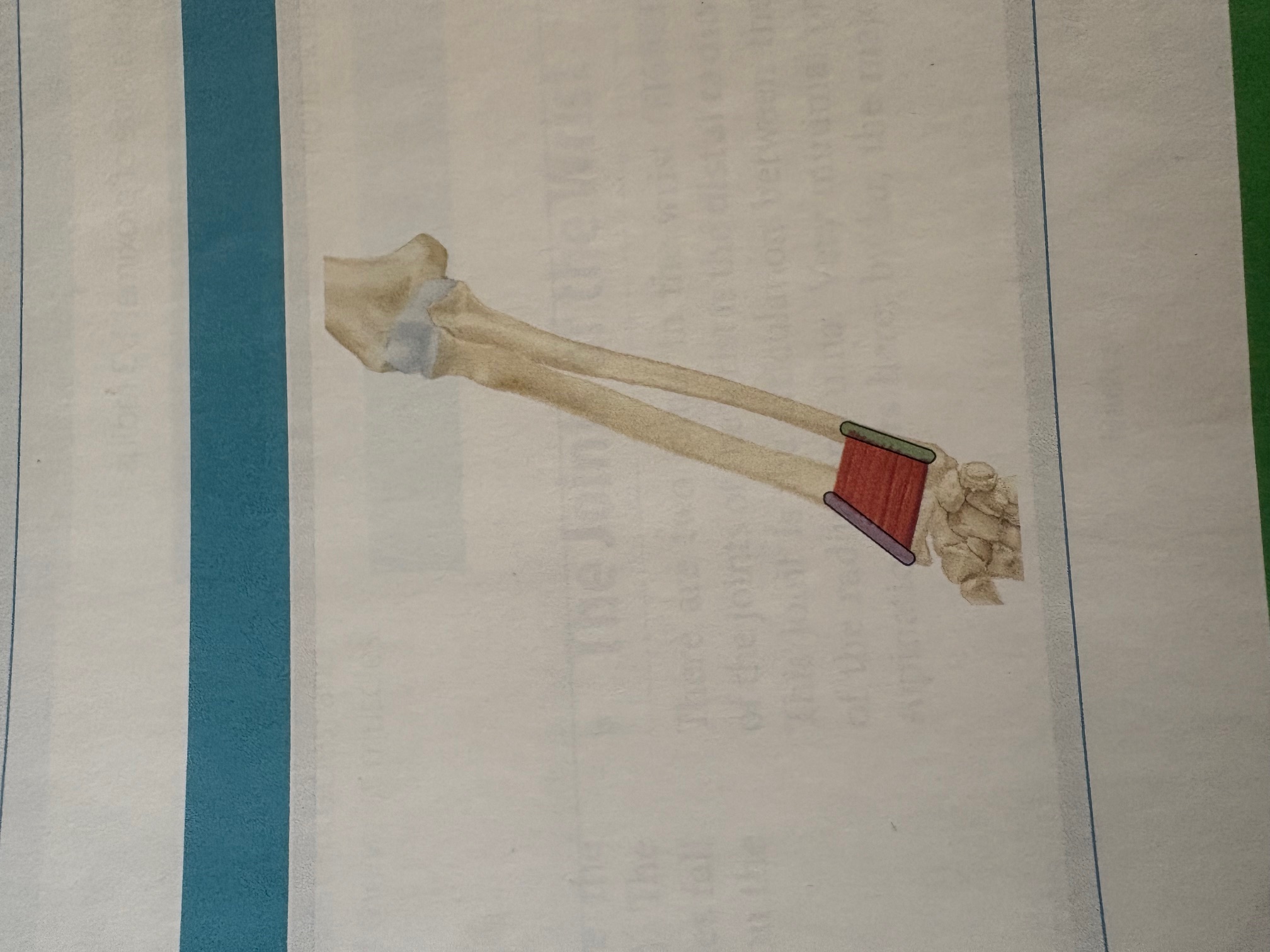 <p>Pronator Quadratus</p>