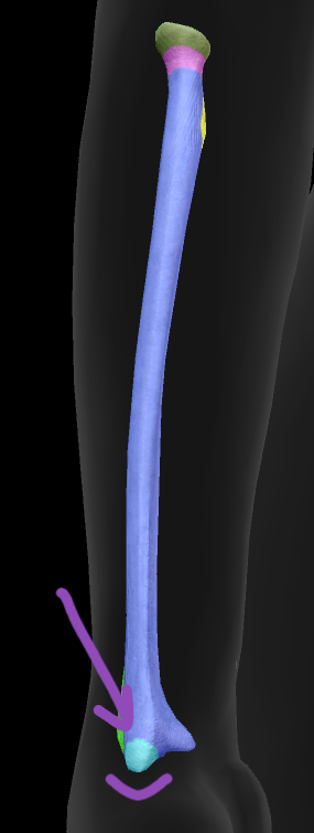 term image