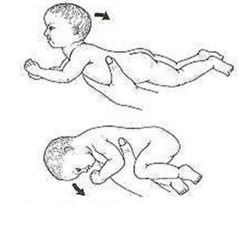 <p>This is an example of what reflex…</p>