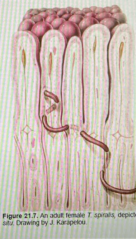 <ul><li><p>very small </p><ul><li><p>females: ~ 3mm</p></li><li><p>males: ~ 1.5 mm</p></li></ul></li><li><p>stichocytes </p><ul><li><p>glandular cells in esophagus </p></li><li><p>excretory-secretory antigen (ESA) </p></li></ul></li><li><p>live in SI</p><ul><li><p>intramulticellular in epithlial cells (within many cells)</p></li></ul></li><li><p>female </p><ul><li><p>ovoviviparous → L1</p><ul><li><p>they do produce eggs but do not release the eggs. Instead, they hatch inside the uterus.</p></li></ul></li></ul></li></ul><p></p>