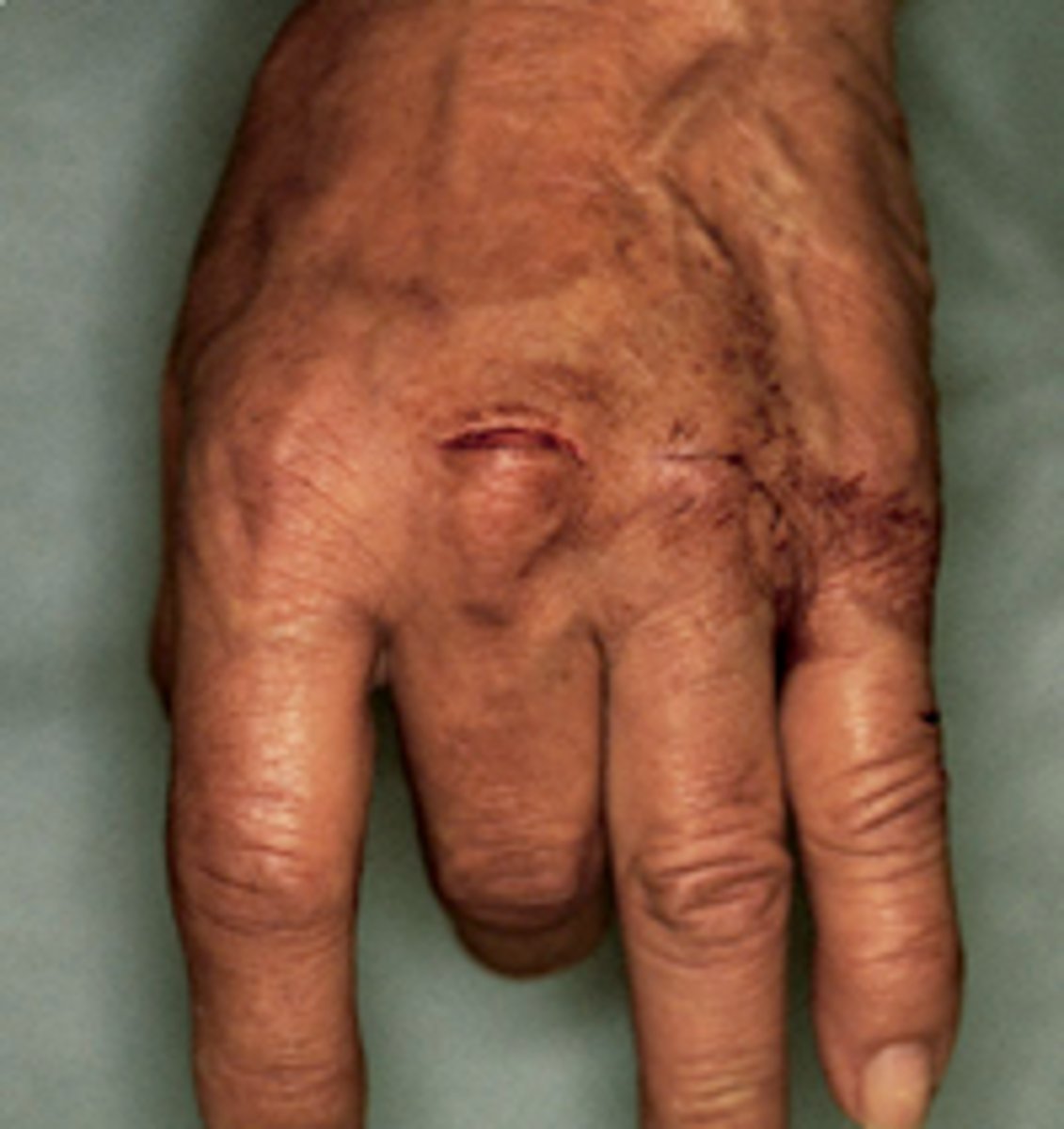 <p>When ~50% lac'd</p>