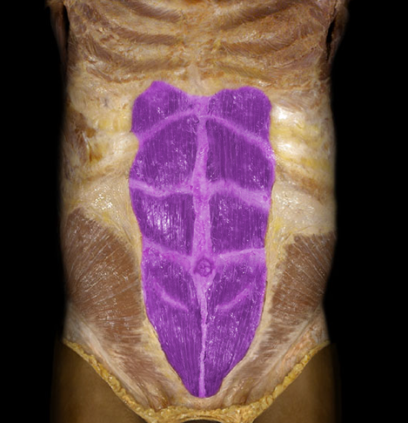 <ul><li><p>Action: Flexion of trunk (sit-ups), Compression of anterior abdominal wall</p></li><li><p>Origin: Pubis (crest and symphysis)</p></li><li><p>Insertion: Sternum (xiphoid process), Costal cartilages 5-7</p></li><li><p>Innervation: Ventral rami of T7-12 spinal nerves</p></li></ul><p></p>