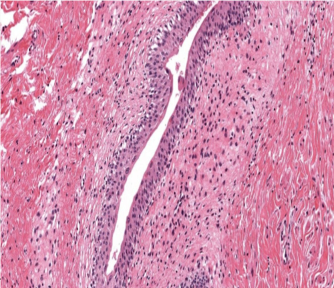 <p>Identify the type of epithelia</p>