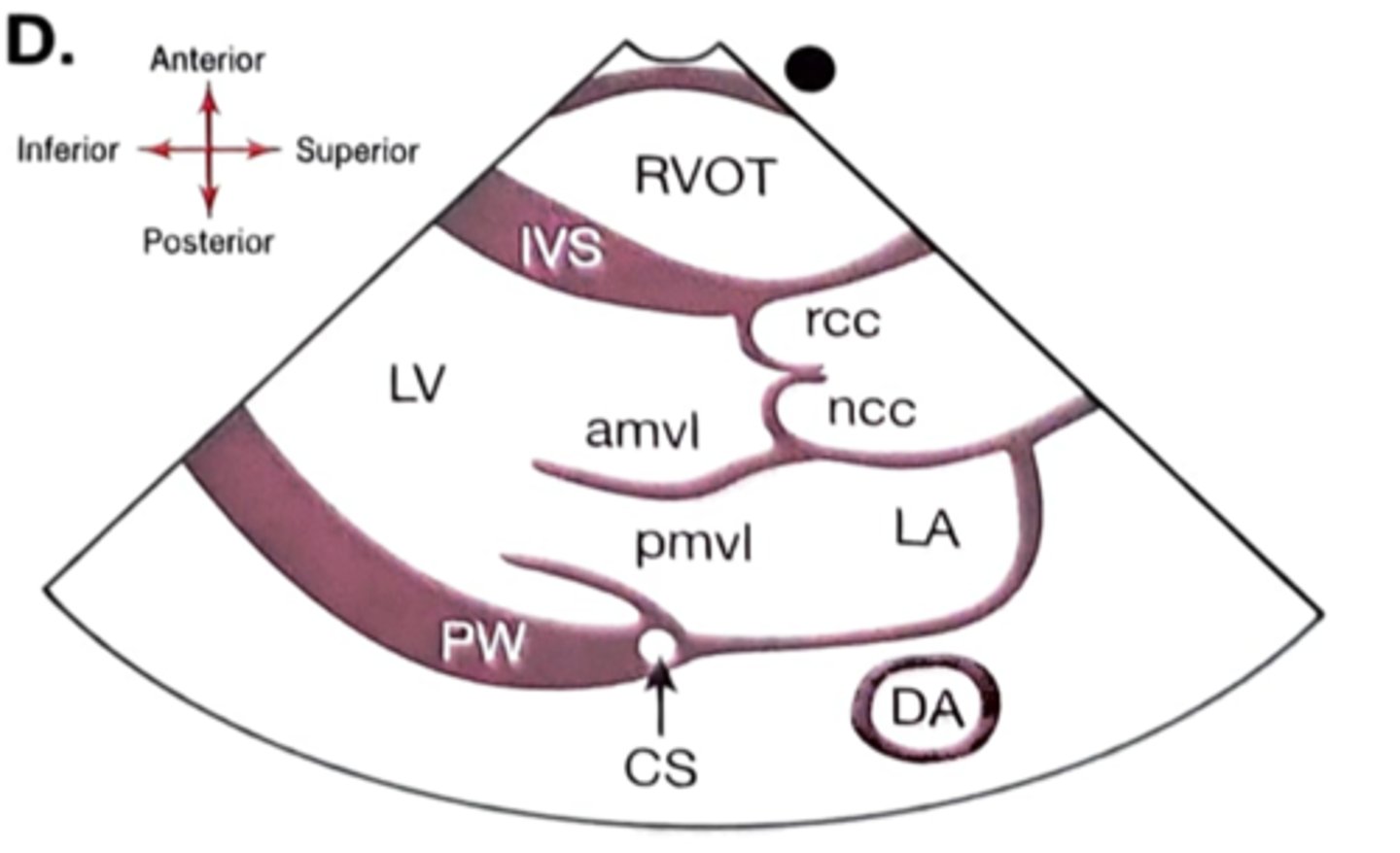 <p>RV-right ventricle</p><p>LV-left ventricle</p><p>LA-left atrium</p><p>AV -aortic valve</p><p>MV-mitral valve</p><p>LVOT-left ventricular outflow tract</p><p>AO -aorta</p><p>IVS-interventricular septum</p><p>PW-posterior wall</p><p>DAO - Descending aorta</p><p>CS- Coronary sinus</p>