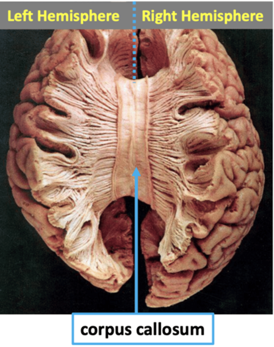 <p>- Two hemispheres connected by the corpus callosum</p><p>- "Mirrored" structures in both hemispheres (left and right side) </p><p>- Ex: Information processed in the right hemisphere communicates to the left by crossing over the corpus callosum: white matter tract: bulk of information crossover </p><p>- <strong>Lateralization</strong>: Behaviours tend to be strongly processed/represented in one hemisphere versus the other </p><p>- Left: Lateralization of Verbal and logical abilities: although language processing occurs in both hem. stronger representation in left for most individuals</p><p>- Right: Lateralization of Spatial relations, music processing </p>