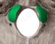 <p>What is the name of this bone in the skull?</p>