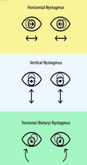 <p>The reflexive eye responses during head rotation</p>